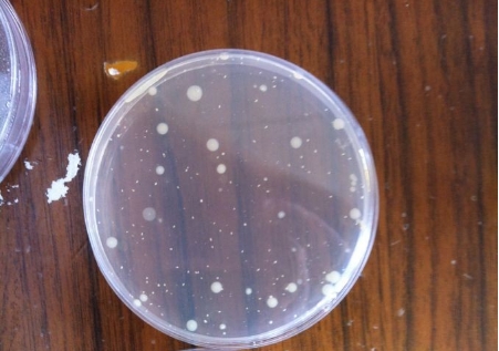 【行業干貨】從原理到實操:一文讀懂薄膜過濾法 vs 平皿法的適用邊界